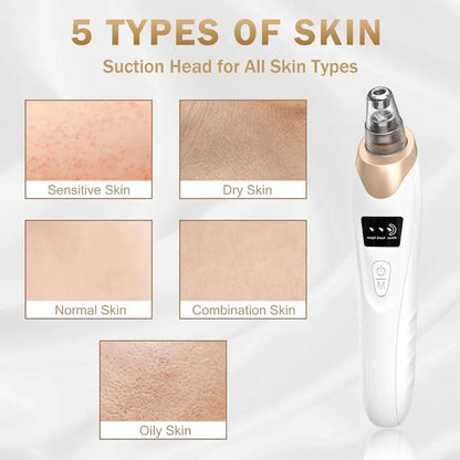 PoreCleaner Pro™ Plus (6 Heads + Steel Toolkit)🎁