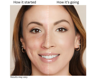 TrueMatchGlow™ by Blossom Colour Changing Foundation - The Foundation That Finds Your Shade 🎀